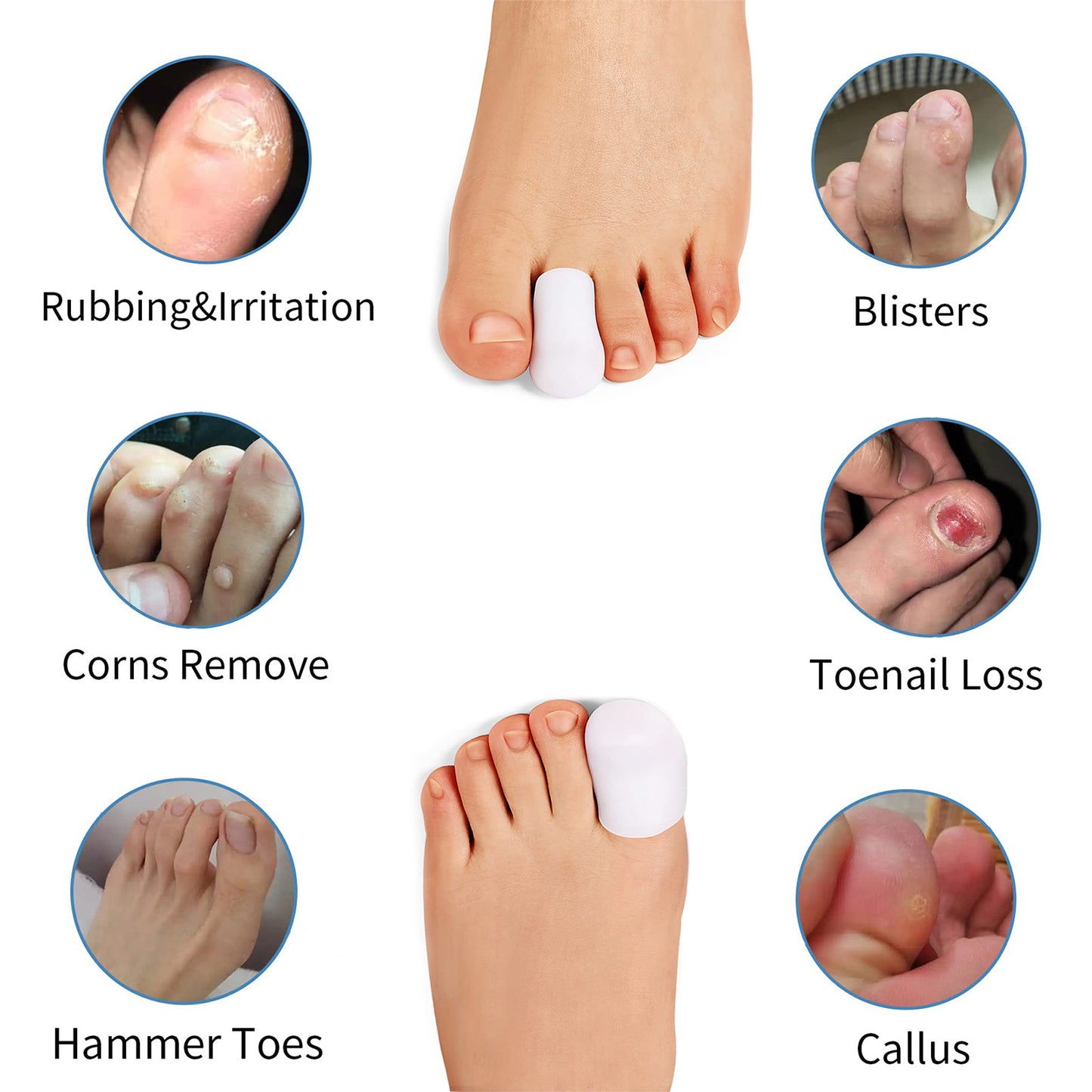 Anzailala Toe Protectors for Men Women Soft Gel Toe Caps for Foot Pain Relief Toe Separator Toe Sleeves for Ingrown Toenails Corns Calluses Blisters - 2 Large + 4 Small (L, 6)